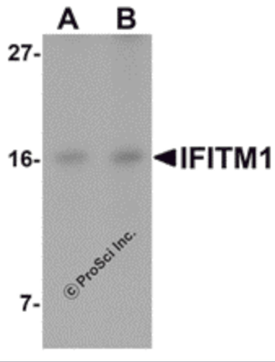 Western blot analysis of IFITM1 in Jurkat cell lysate with IFITM1 antibody at (A) 2.5 and (B) 5 μg/mL.