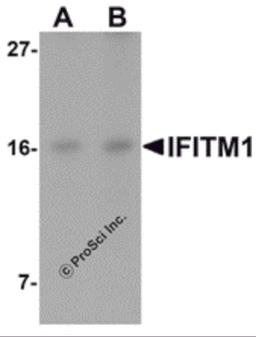 Western blot analysis of IFITM1 in Jurkat cell lysate with IFITM1 antibody at (A) 2.5 and (B) 5 μg/mL.