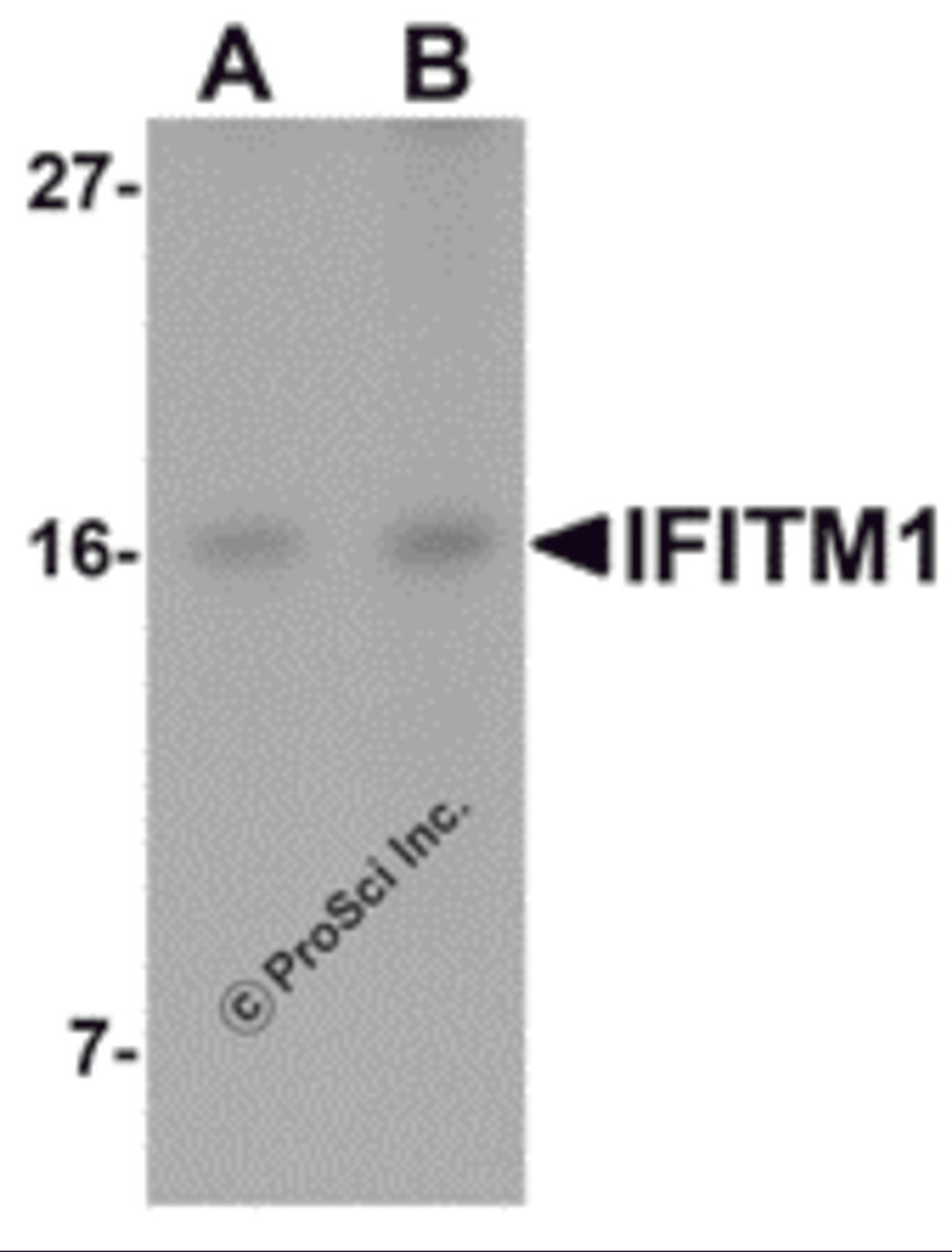 Western blot analysis of IFITM1 in Jurkat cell lysate with IFITM1 antibody at (A) 2.5 and (B) 5 μg/mL.