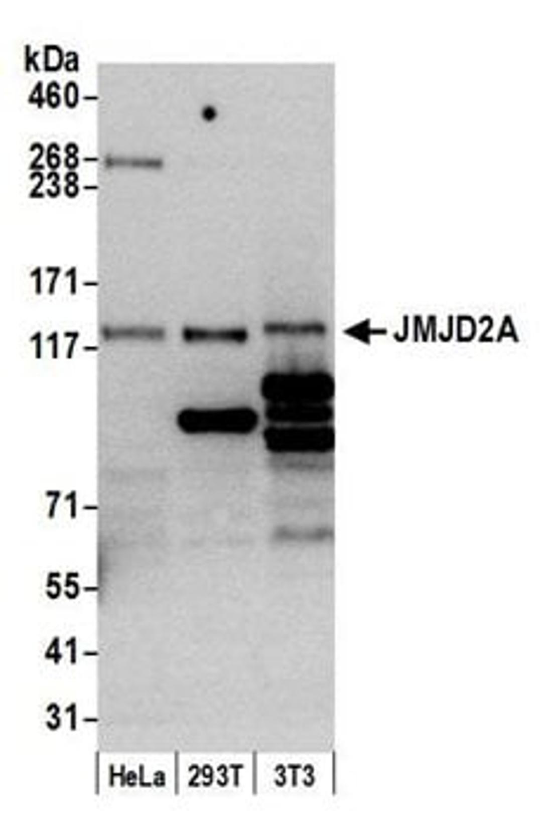 Detection of human and mouse JMJD2A by western blot.