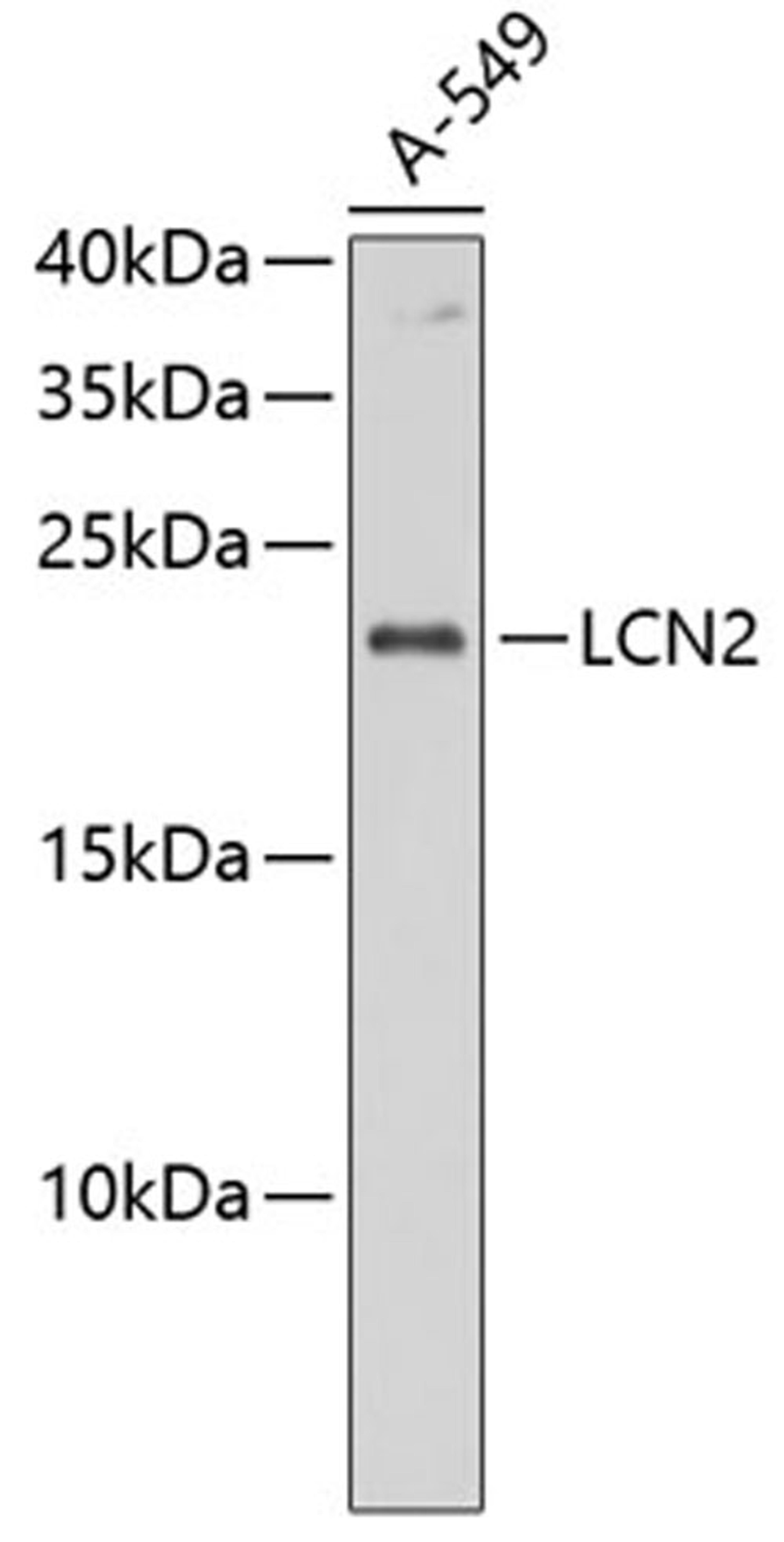 Western blot - LCN2 antibody (A11130)