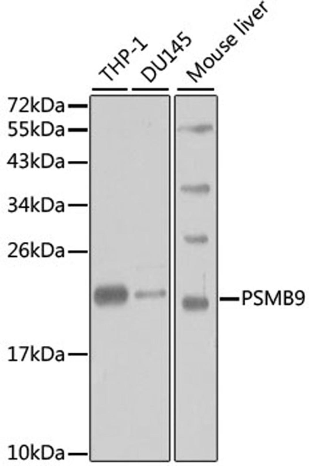 Western blot - PSMB9 antibody (A1771)