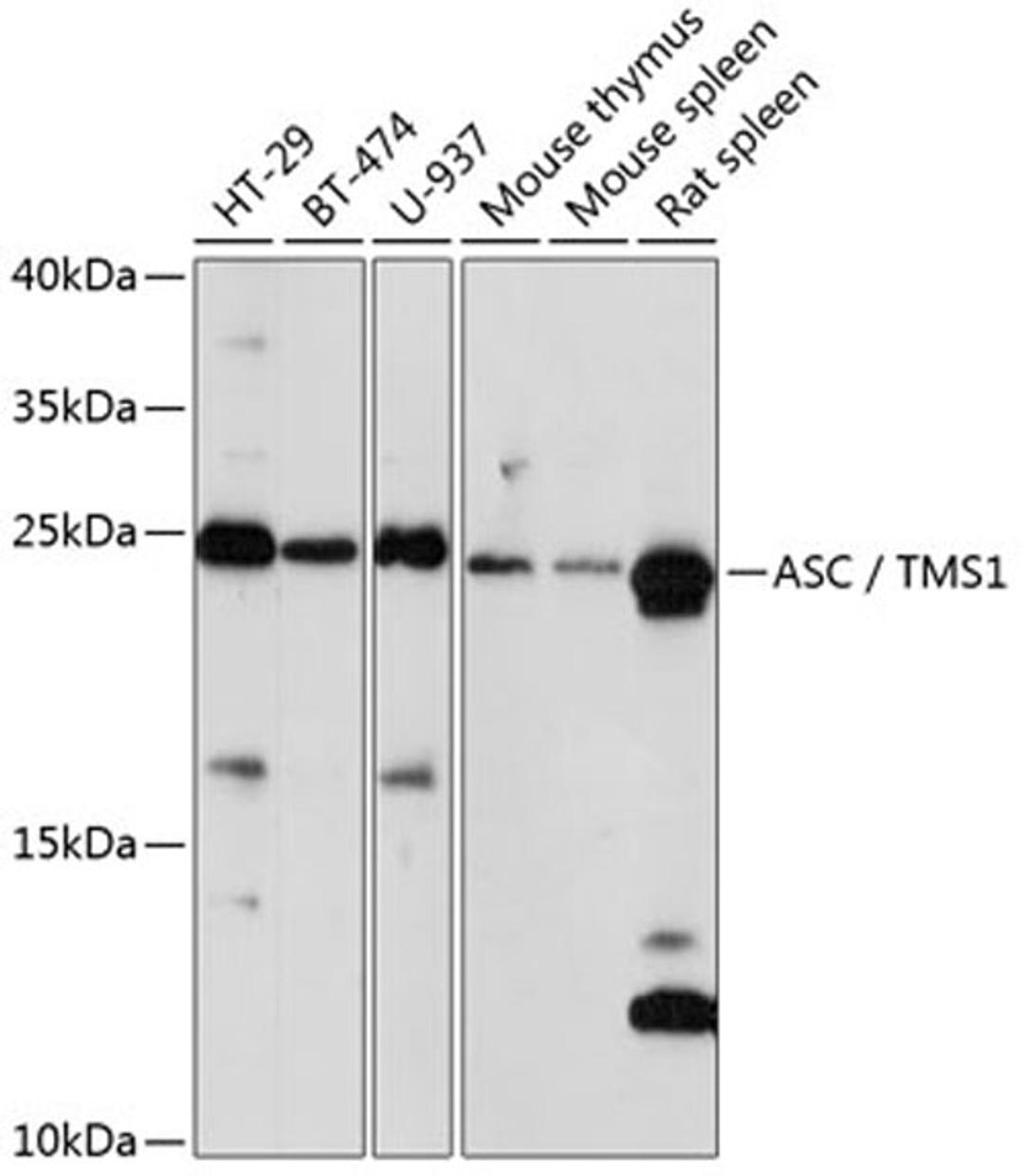 Western blot - ASC / TMS1 antibody (A16672)