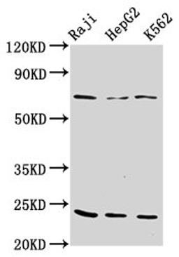 Western Blot. Positive WB detected in: Raji whole cell lysate, HepG2 whole cell lysate, K562 whole cell lysate. All lanes: PSMB9 antibody at 10µg/ml. Secondary. Goat polyclonal to rabbit IgG at 1/50000 dilution. Predicted band size: 24, 23 kDa. Observed band size: 24 kDa
