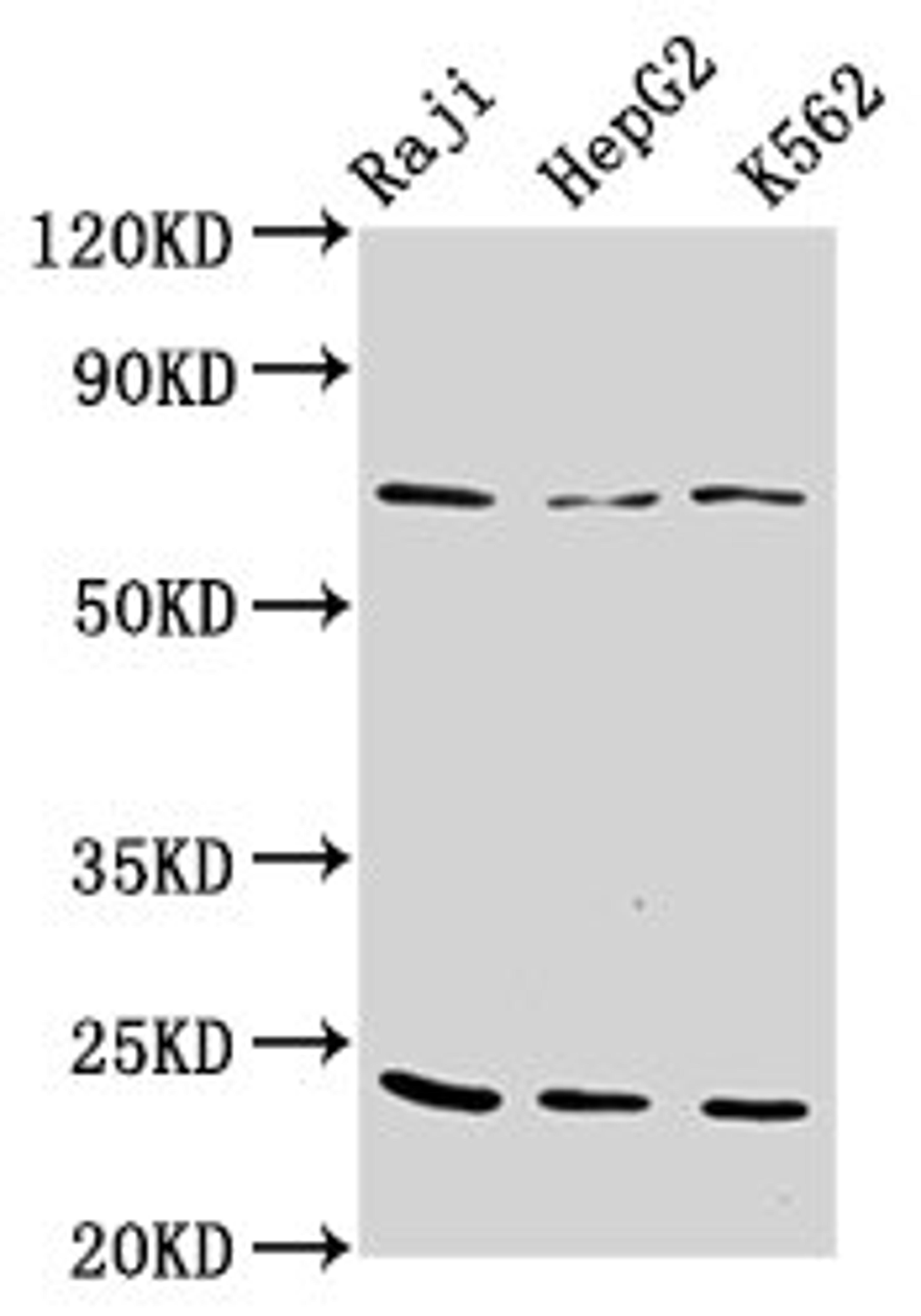 Western Blot. Positive WB detected in: Raji whole cell lysate, HepG2 whole cell lysate, K562 whole cell lysate. All lanes: PSMB9 antibody at 10µg/ml. Secondary. Goat polyclonal to rabbit IgG at 1/50000 dilution. Predicted band size: 24, 23 kDa. Observed band size: 24 kDa