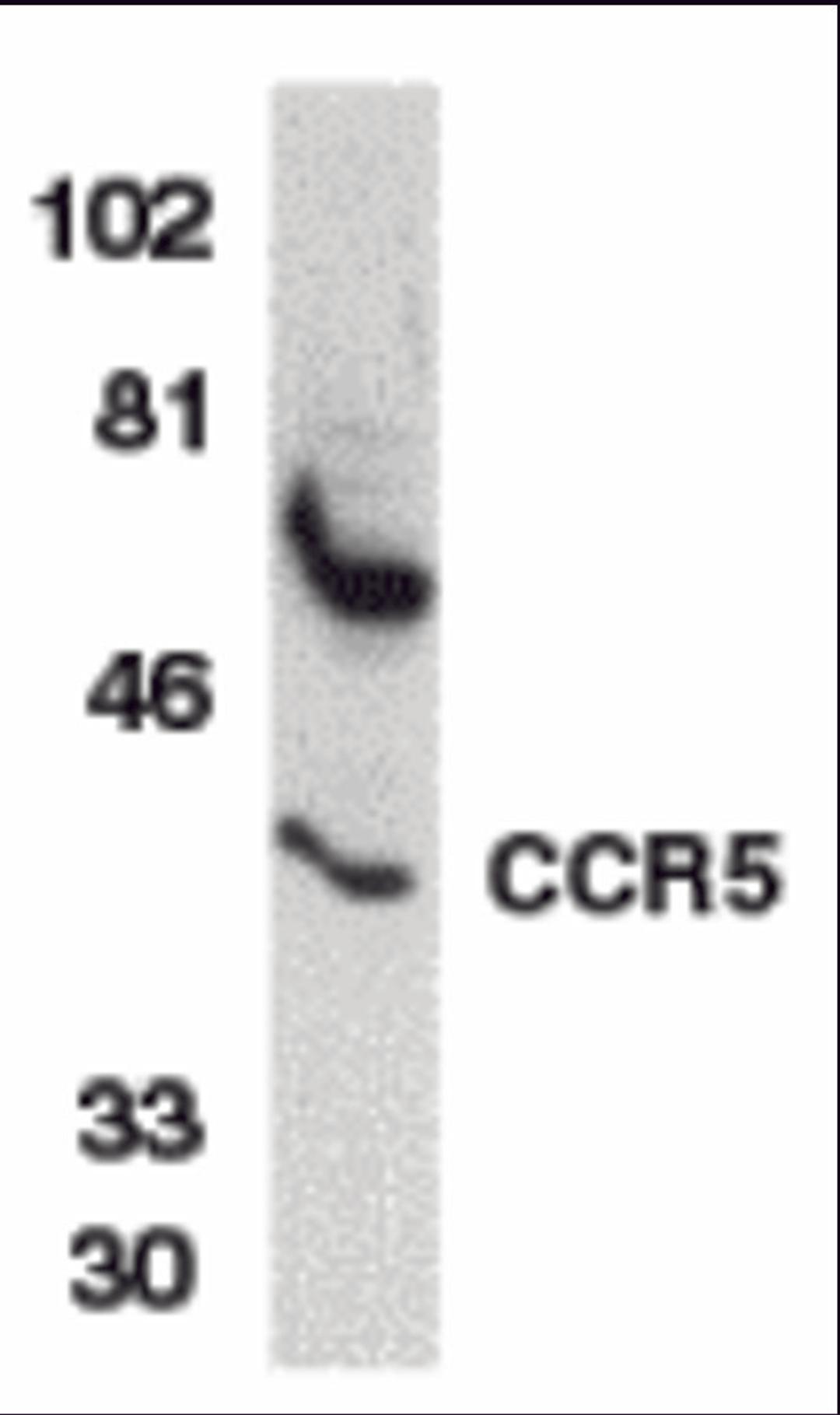 Western blot analysis of CCR5 in THP-1 whole cell lysate with CCR5 antibody at 1 μg/mL.