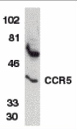 Western blot analysis of CCR5 in THP-1 whole cell lysate with CCR5 antibody at 1 μg/mL.
