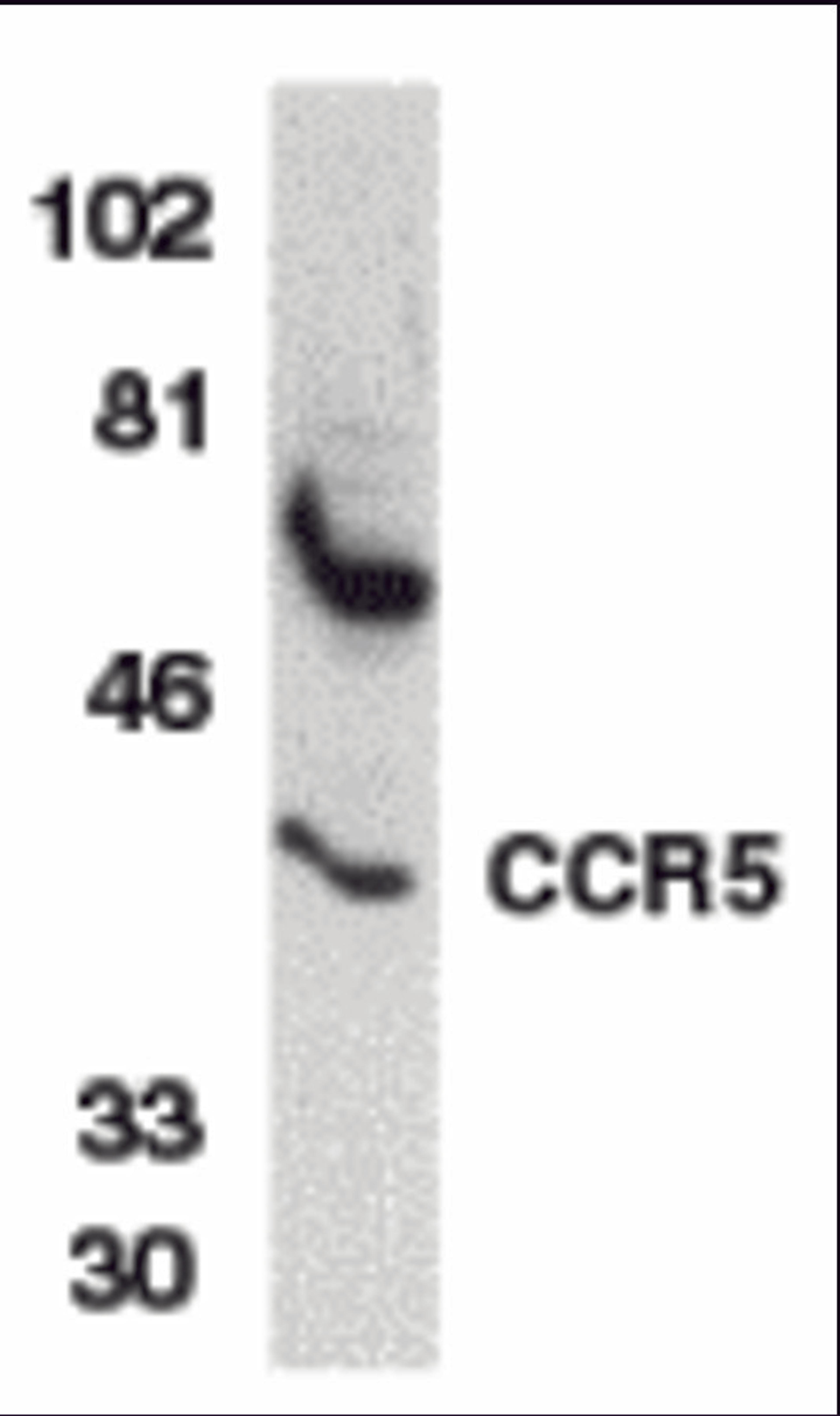 Western blot analysis of CCR5 in THP-1 whole cell lysate with CCR5 antibody at 1 μg/mL.