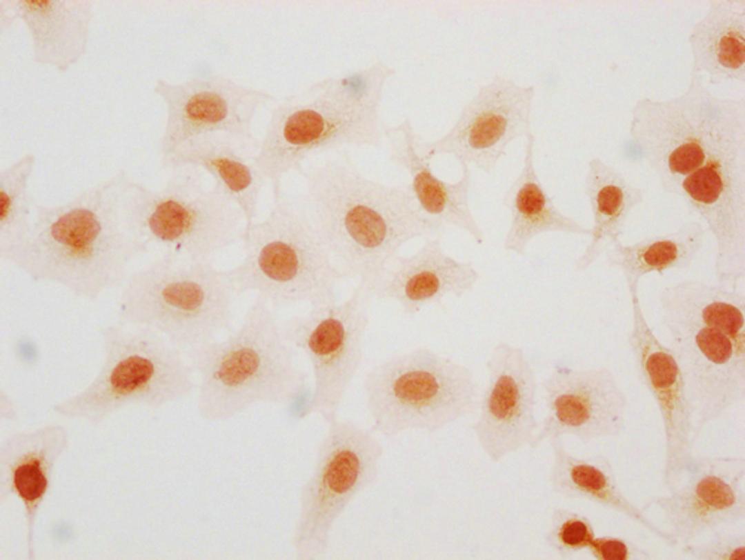 Immunocytochemistry analysis of CSB-PA010403PA57hibHU diluted at 1:15 and staining in Hela cells(treated with 30mM sodium butyrate for 4h) performed on a Leica BondTM system. The cells were fixed in 4% formaldehyde, permeabilized using 0.2% Triton X-100 and blocked with 10% normal goat serum 30min at RT. Then primary antibody (1% BSA) was incubated at 4°C overnight. The primary is detected by a biotinylated secondary antibody and visualized using an HRP conjugated SP system.
