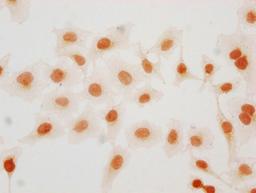 Immunocytochemistry analysis of CSB-PA010403PA57hibHU diluted at 1:15 and staining in Hela cells(treated with 30mM sodium butyrate for 4h) performed on a Leica BondTM system. The cells were fixed in 4% formaldehyde, permeabilized using 0.2% Triton X-100 and blocked with 10% normal goat serum 30min at RT. Then primary antibody (1% BSA) was incubated at 4°C overnight. The primary is detected by a biotinylated secondary antibody and visualized using an HRP conjugated SP system.