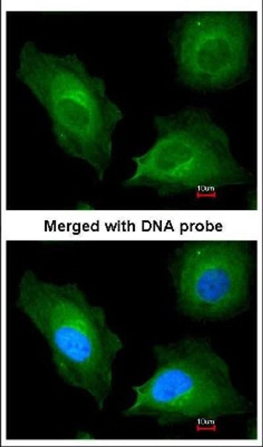 Immunocytochemistry/Immunofluorescence: RAB6A Antibody [NBP1-33110] - Analysis of paraformaldehyde-fixed HeLa