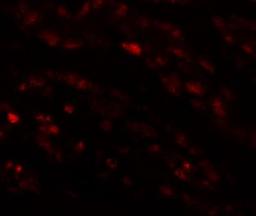 Immunocytochemistry/Immunofluorescence: EFCAB4B Antibody [NBP1-76493] - Immunofluorescence of EFCAB4B in human kidney tissue with EFCAB4B antibody at 20 ug/mL.