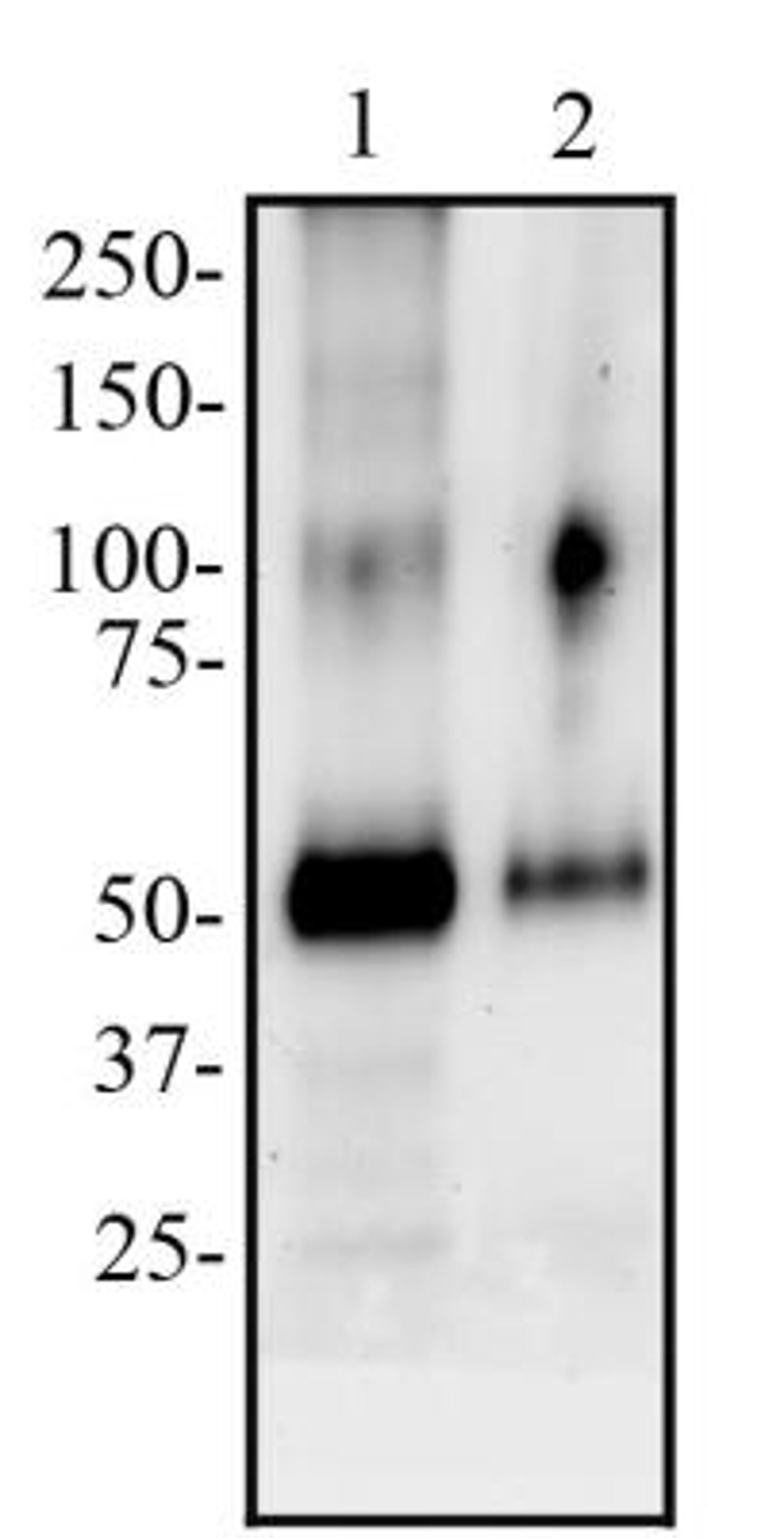 Western Blot: Peripheral Node Addressin Antibody (MECA-79) [NB100-77673] - Total protein from Human tonsil (lane 1) and human lymph node (lane 2) was separated on a 7.5% gel by SDS-PAGE, transferred to PVDF membrane and blocked in 5% non-fat milk in TBST. The membrane was probed with 2 ug/ml anti-PNAd in 1% milk, and detected with an anti-rat IgM HRP conjugated secondary antibody using chemiluminescence.