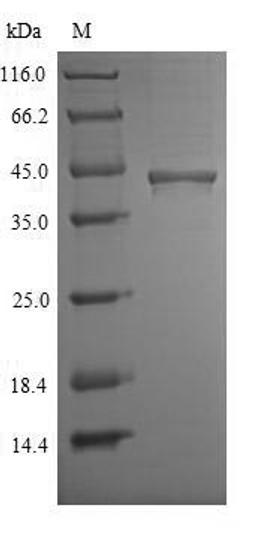 (Tris-Glycine gel) Discontinuous SDS-PAGE (reduced) with 5% enrichment gel and 15% separation gel.