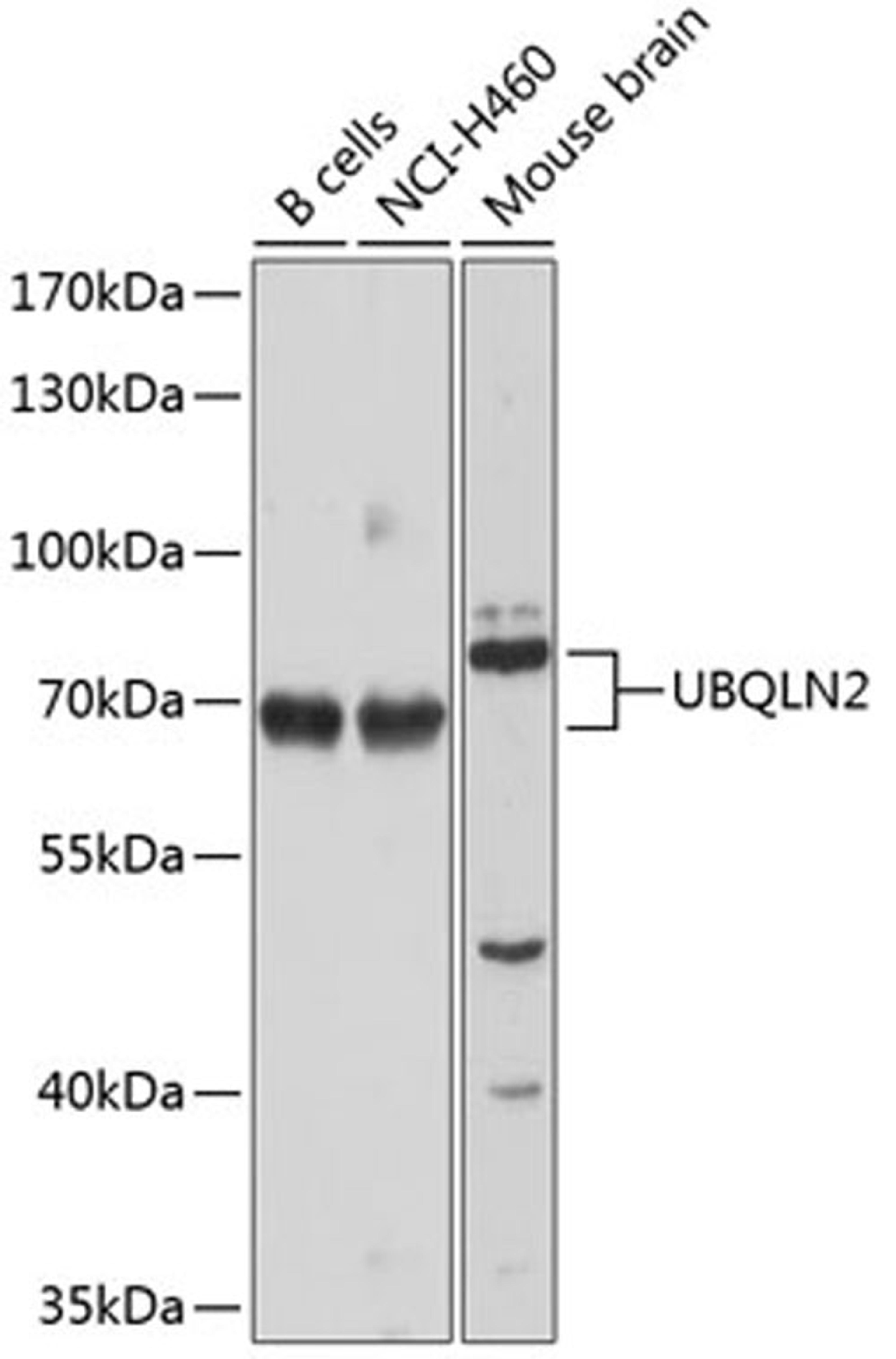 Western blot - UBQLN2 antibody (A9568)