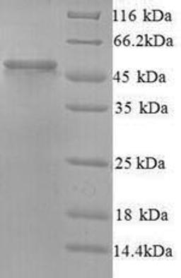 (Tris-Glycine gel) Discontinuous SDS-PAGE (reduced) with 5% enrichment gel and 15% separation gel.