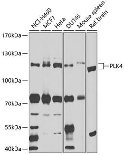 Western blot - PLK4 antibody (A9863)