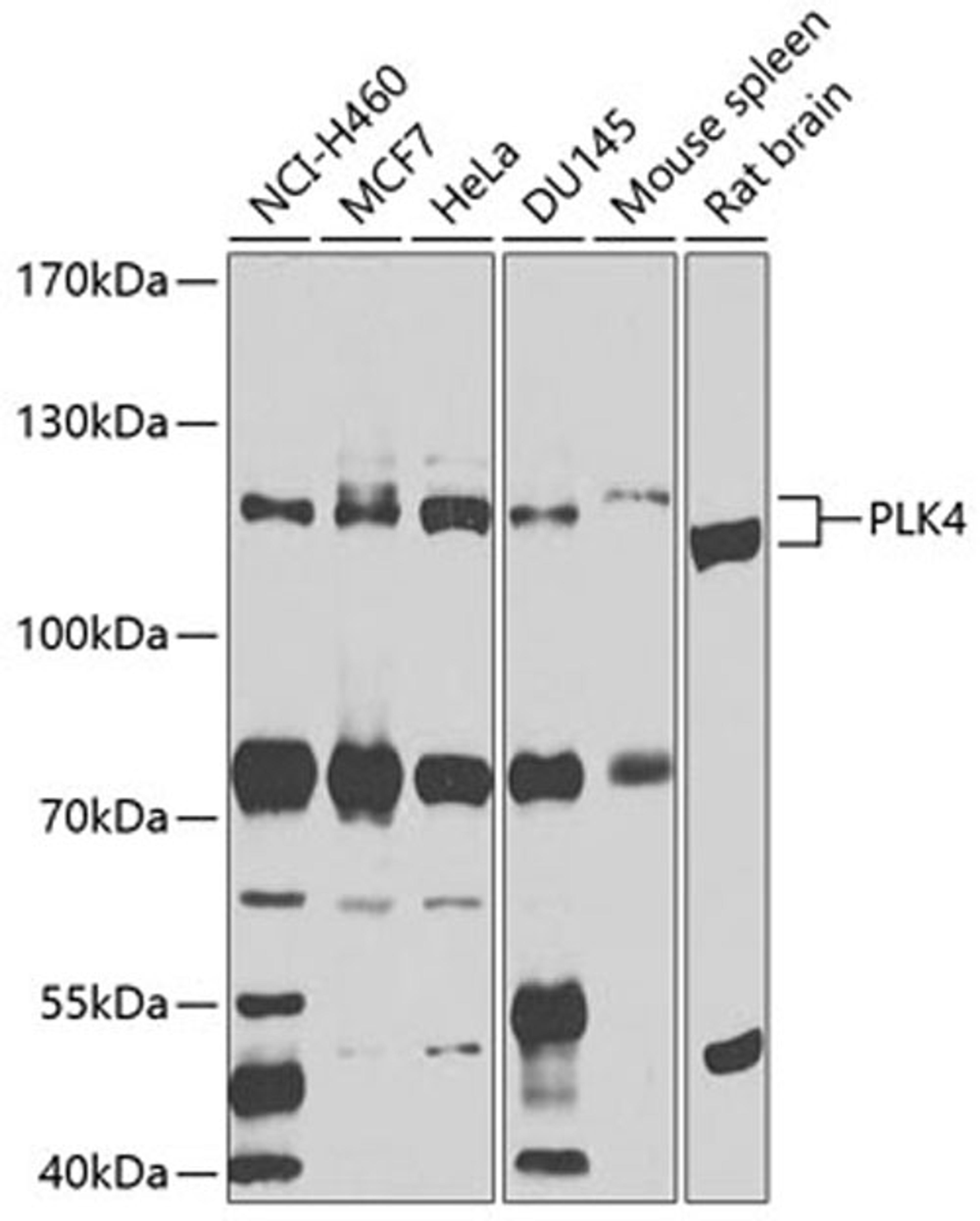 Western blot - PLK4 antibody (A9863)