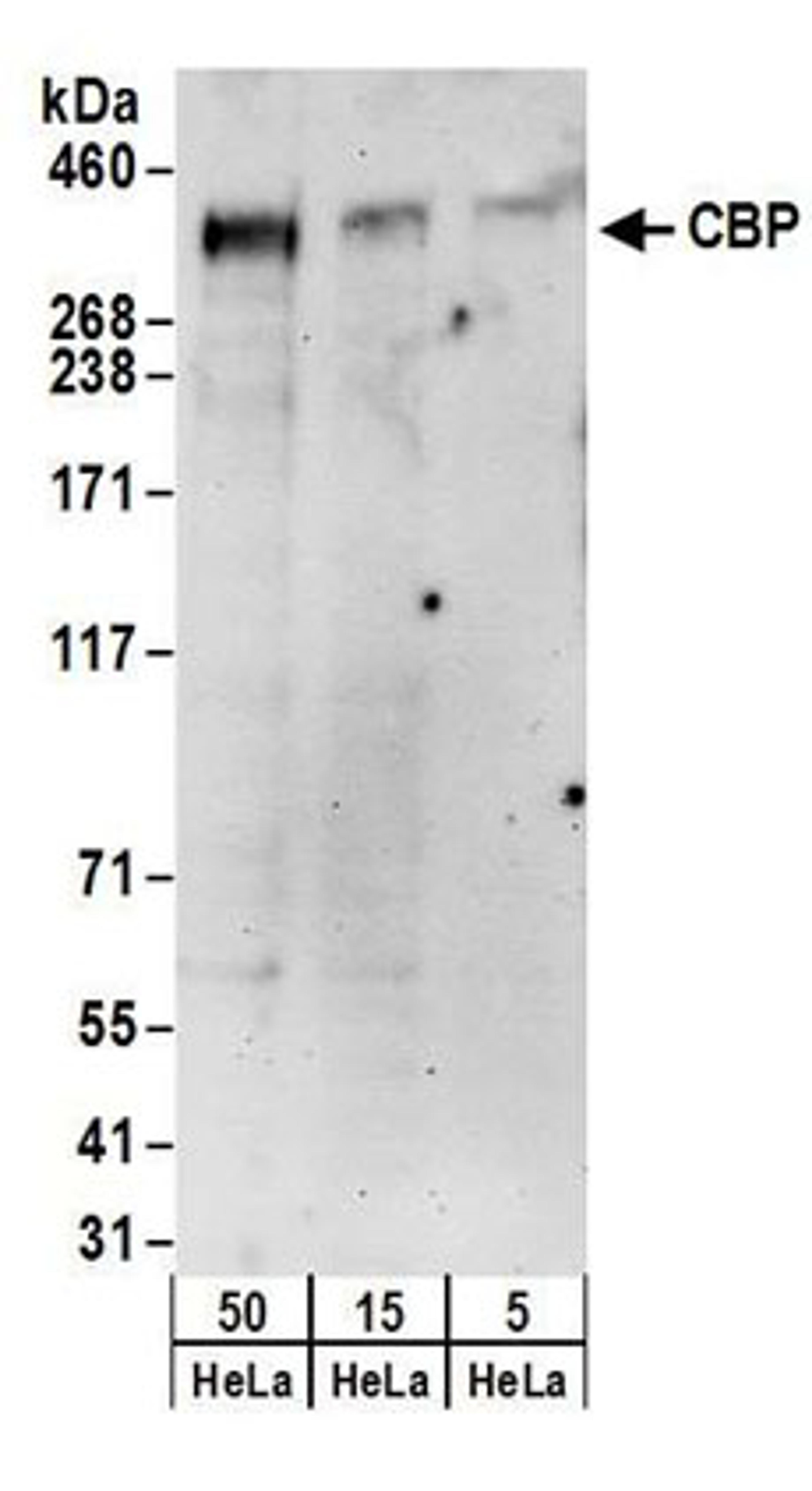 Detection of human CBP by western blot.