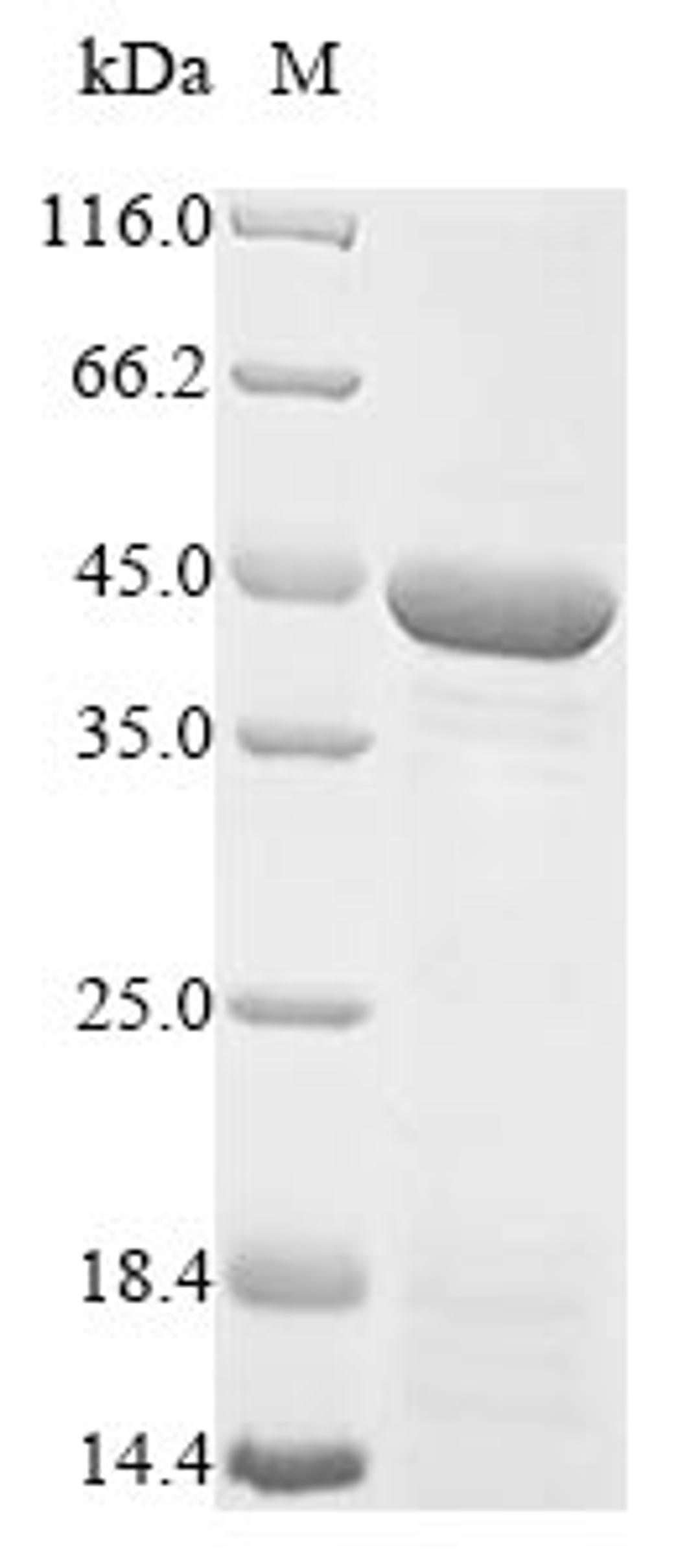 (Tris-Glycine gel) Discontinuous SDS-PAGE (reduced) with 5% enrichment gel and 15% separation gel.