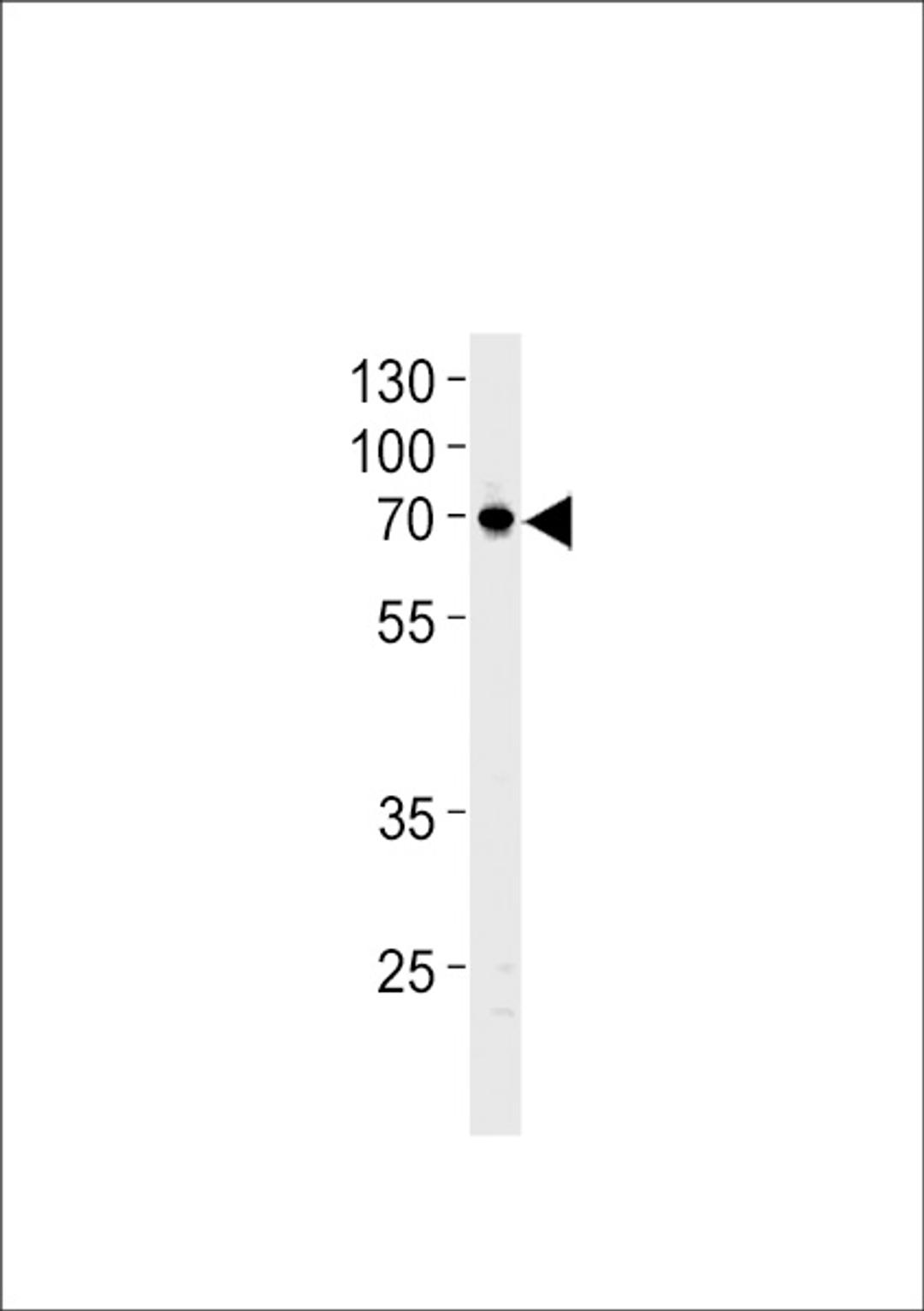 Western blot analysis in U87-MG cell line lysates (35ug/lane).