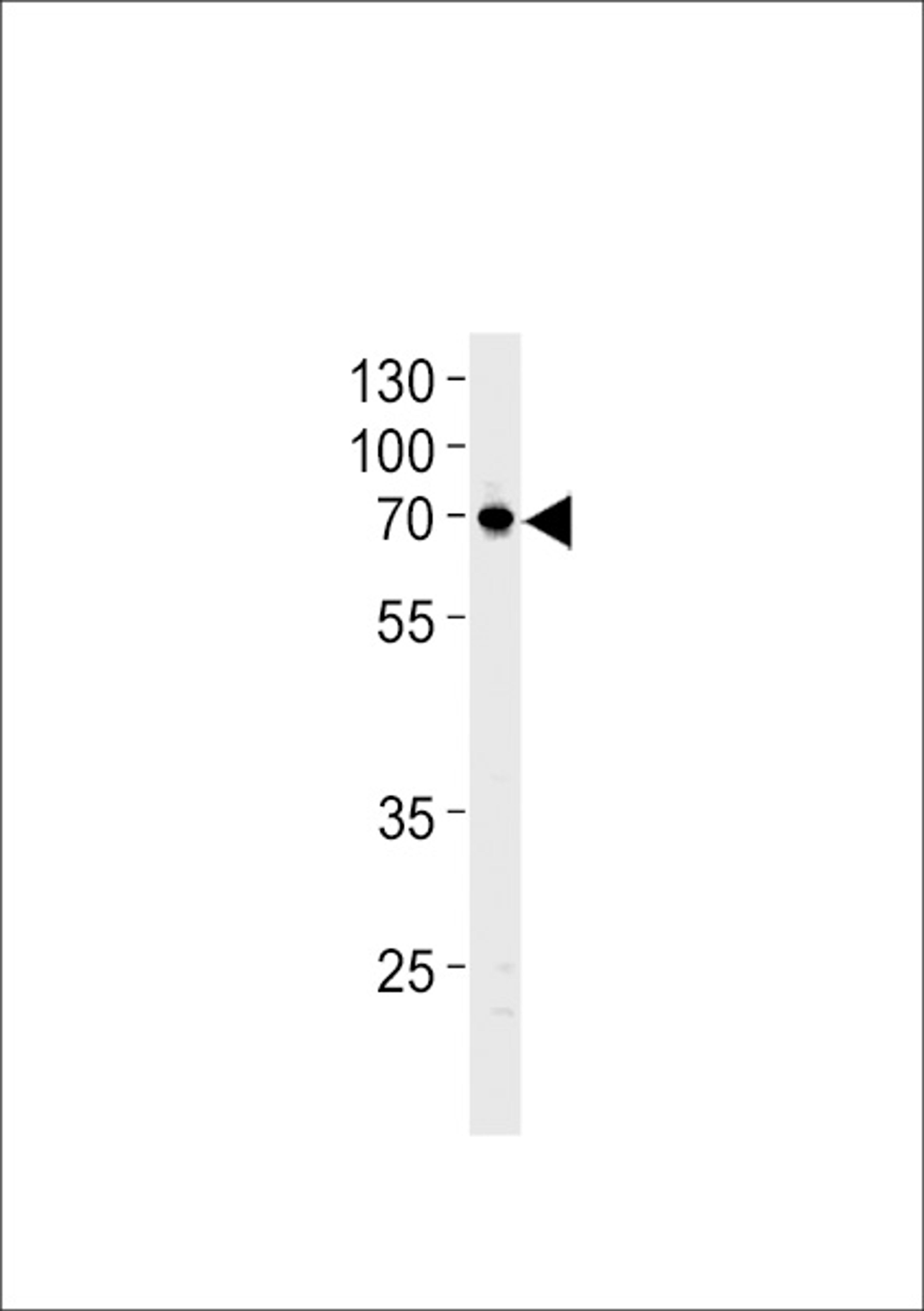 Western blot analysis in U87-MG cell line lysates (35ug/lane).