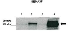 Western Blot: Semaphorin 3F Antibody [NBP1-91480] - Positive control: Lane1 : No transfection, Lane, 2: Cell lysates from HEK293 cells were transfected with alkaline phosphatase (AP-) tagged Sema3F, Lane3: AP-alone, Lane4: The cell media from cells transfected with AP-Sema3F Primary, Antibody Dilution: 1 ug/ml Secondary Antibody: Anti-AP Secondry, Antibody Dilution: 1 : 1000.