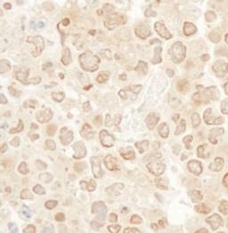 Detection of mouse MCAK by immunohistochemistry.