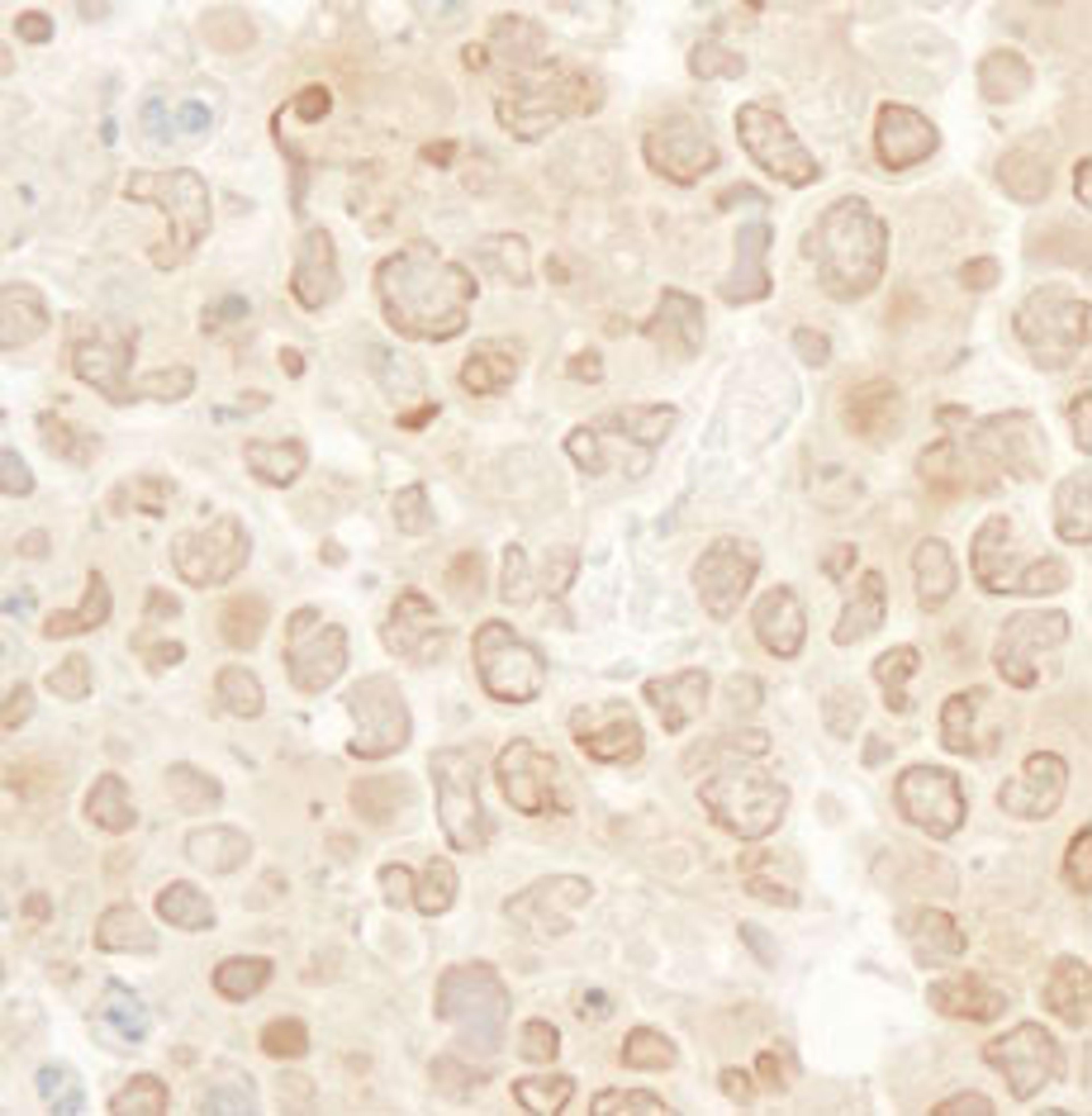 Detection of mouse MCAK by immunohistochemistry.