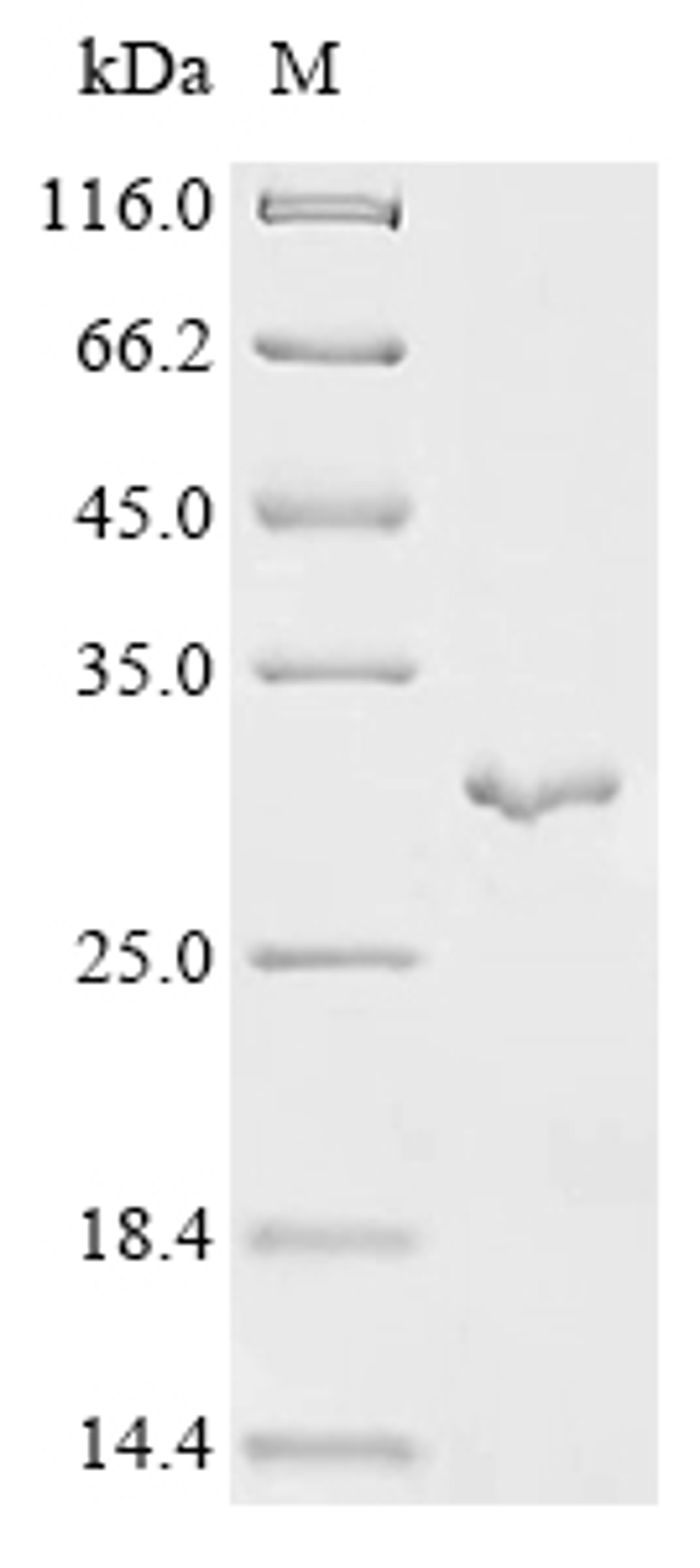 (Tris-Glycine gel) Discontinuous SDS-PAGE (reduced) with 5% enrichment gel and 15% separation gel.