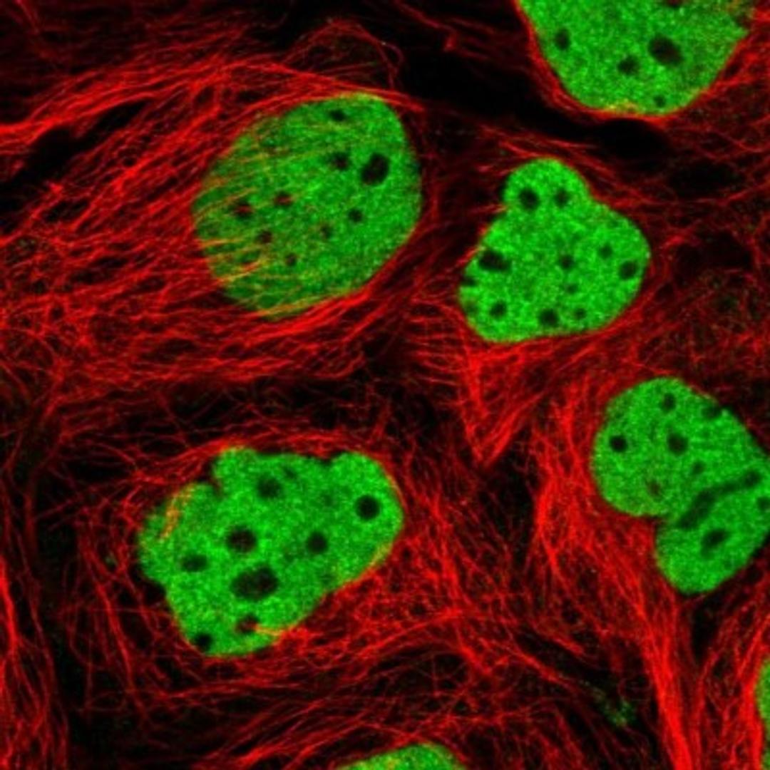 Immunocytochemistry/Immunofluorescence: ARID3B Antibody [NBP2-33596] - Immunofluorescent staining of human cell line CACO-2 shows positivity in nucleus but not nucleoli.