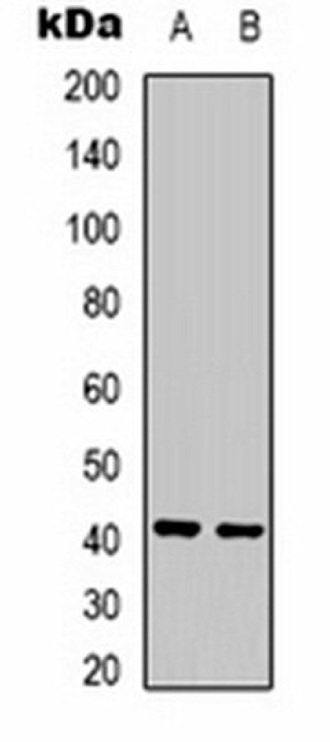 Western blot analysis of Jurkat (Lane 1), rat liver (Lane 2) whole cell lysates using Ghrelin Receptor antibody