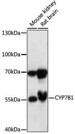 Western blot - CYP7B1 antibody (A17872)