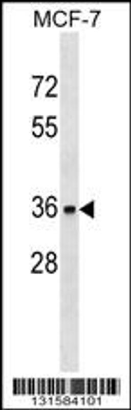 Western blot analysis in MCF-7 cell line lysates (35ug/lane).