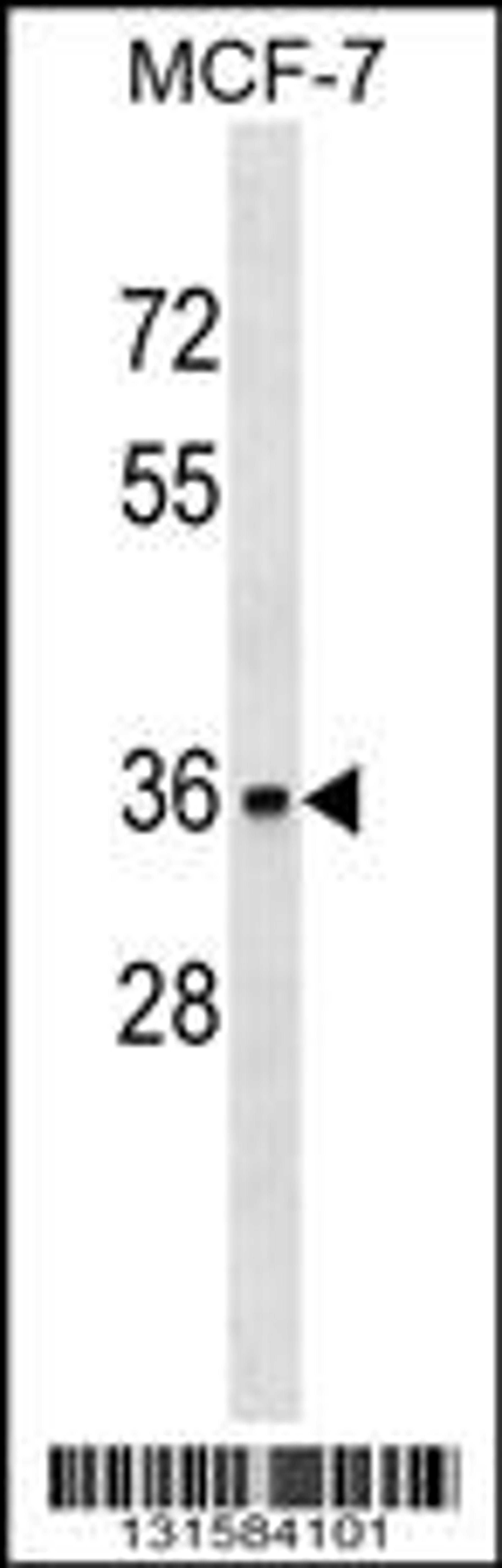 Western blot analysis in MCF-7 cell line lysates (35ug/lane).