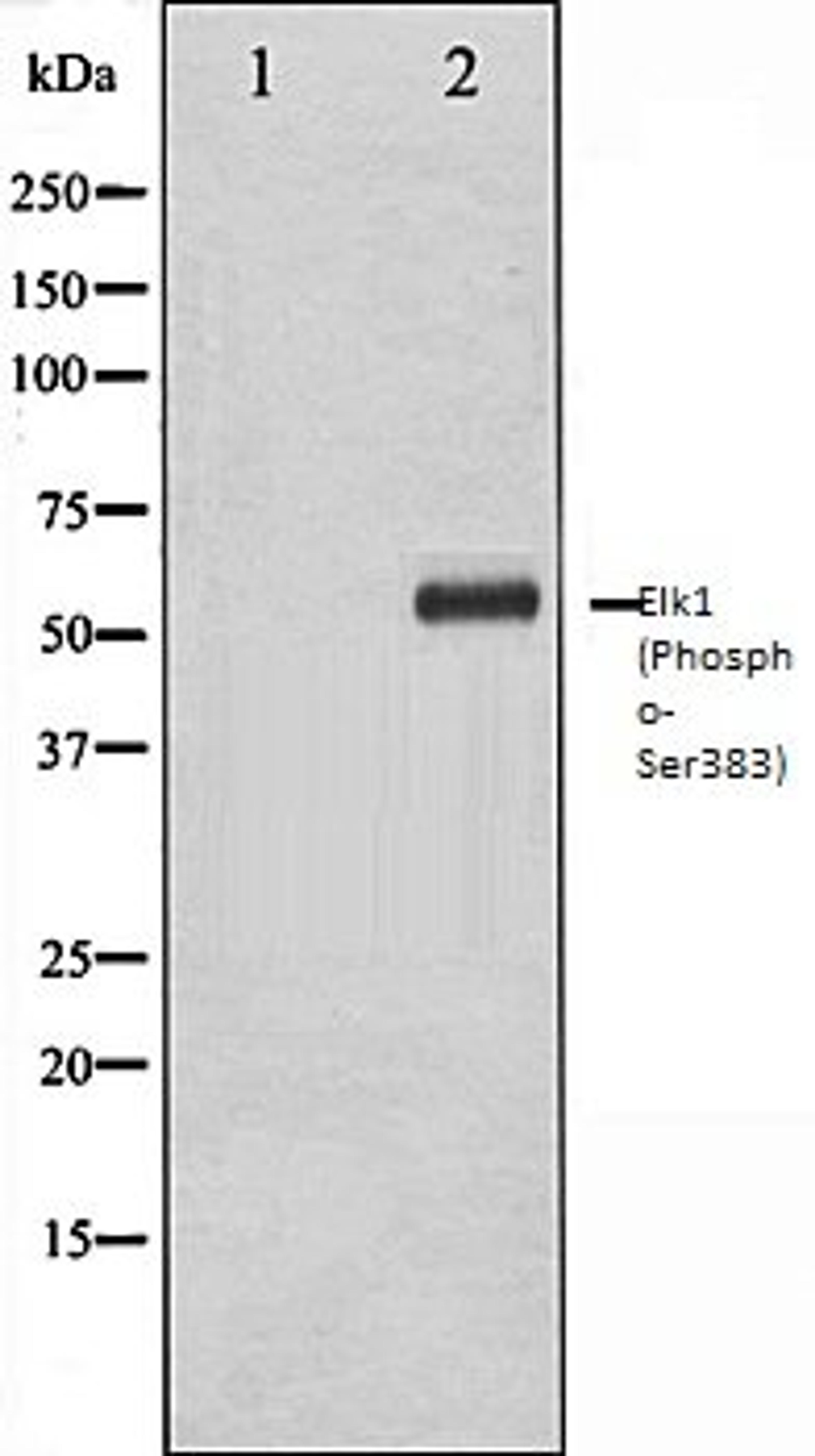 Western blot analysis of HeLa whole cell lysates using Elk1 (Phospho-Ser383) antibody, The lane on the left is treated with the antigen-specific peptide.