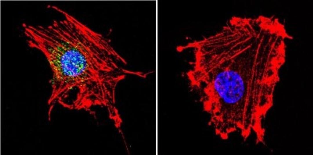 Immunocytochemistry/Immunofluorescence: Parvalbumin Antibody [NB120-11427] - Analysis of Parvalbumin using Anti-Parvalbumin Polyclonal Antibody shows staining in C6 Cells. Parvalbumin staining (green), F-Actin staining with Phalloidin (red) and nuclei with DAPI (blue) is shown. Cells were grown on chamber slides and fixed with formaldehyde prior to staining. Cells were probed without (control) or with or an antibody recognizing Parvalbumin at a dilution of 1:100 over night at 4C, washed with PBS and incubated with a DyLight-488 conjugated.