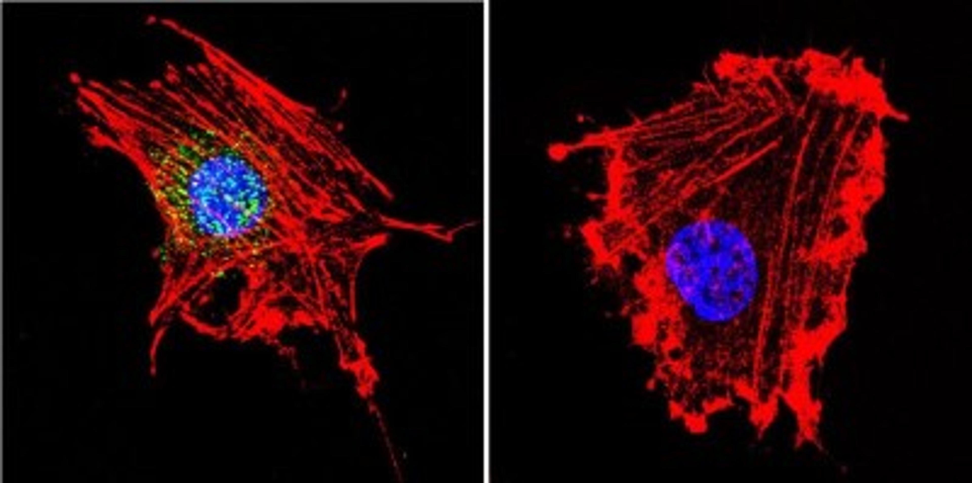 Immunocytochemistry/Immunofluorescence: Parvalbumin Antibody [NB120-11427] - Analysis of Parvalbumin using Anti-Parvalbumin Polyclonal Antibody shows staining in C6 Cells. Parvalbumin staining (green), F-Actin staining with Phalloidin (red) and nuclei with DAPI (blue) is shown. Cells were grown on chamber slides and fixed with formaldehyde prior to staining. Cells were probed without (control) or with or an antibody recognizing Parvalbumin at a dilution of 1:100 over night at 4C, washed with PBS and incubated with a DyLight-488 conjugated.