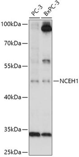 Western blot - NCEH1 antibody (A17741)