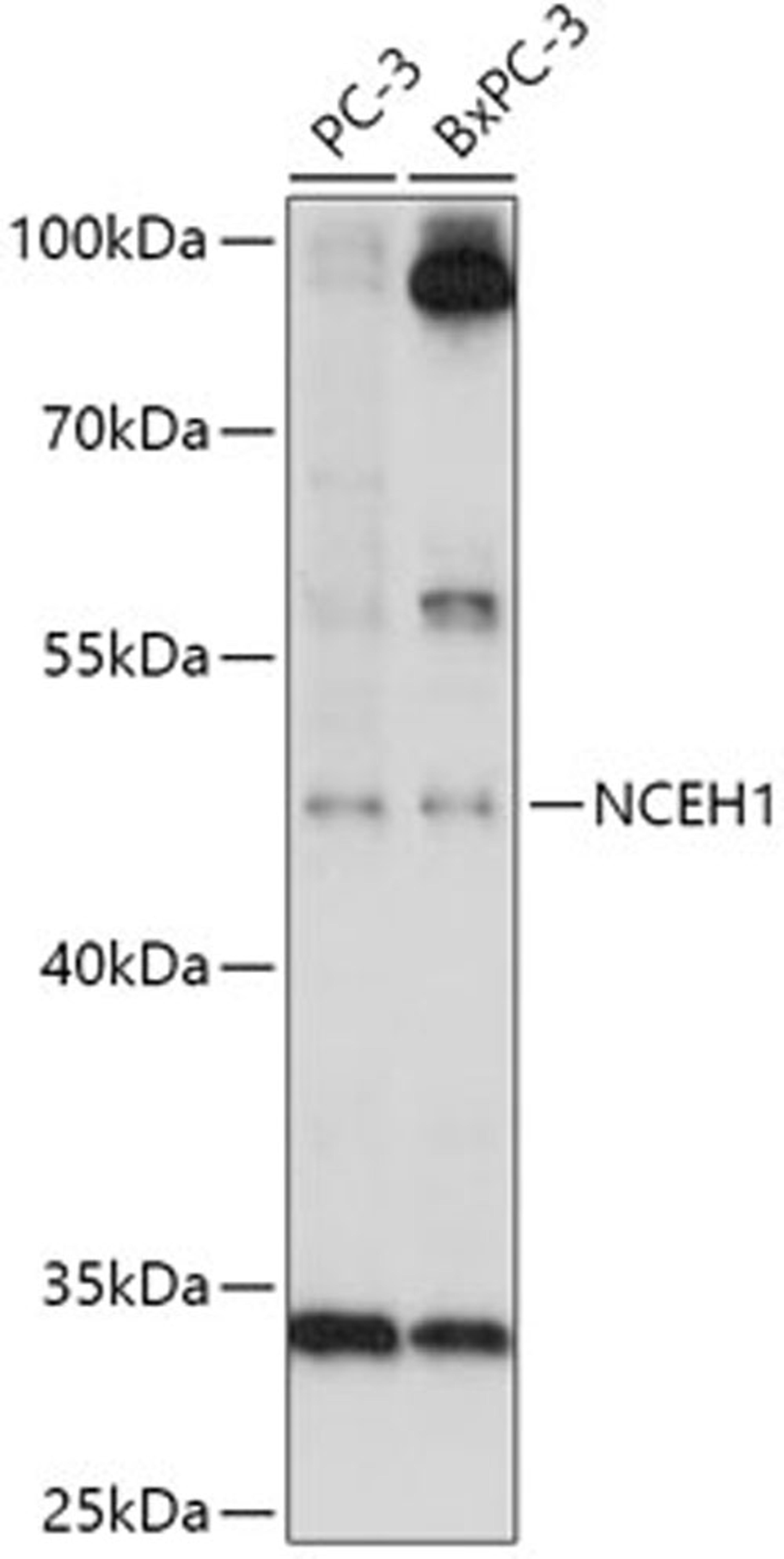 Western blot - NCEH1 antibody (A17741)