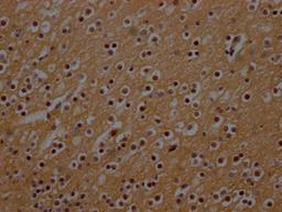 IHC image of CSB-PA015686LA01HU diluted at 1:300 and staining in paraffin-embedded human brain tissue performed on a Leica BondTM system. After dewaxing and hydration, antigen retrieval was mediated by high pressure in a citrate buffer (pH 6.0). Section was blocked with 10% normal goat serum 30min at RT. Then primary antibody (1% BSA) was incubated at 4°C overnight. The primary is detected by a Goat anti-rabbit polymer IgG labeled by HRP and visualized using 0.05% DAB.