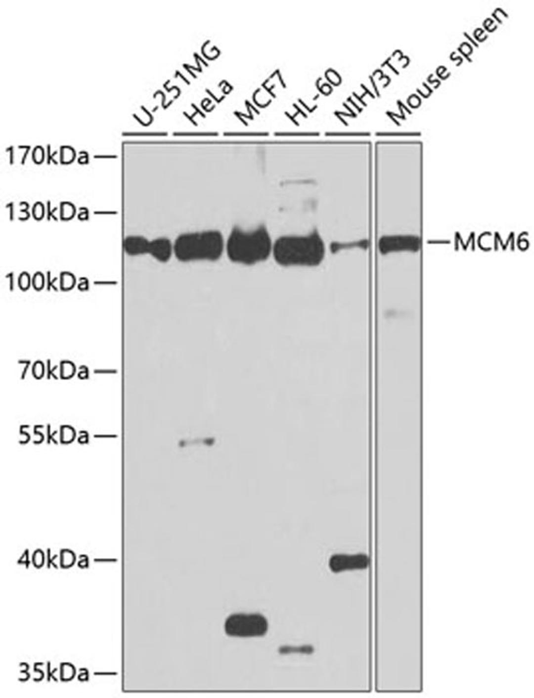 Western blot - MCM6 antibody (A1955)