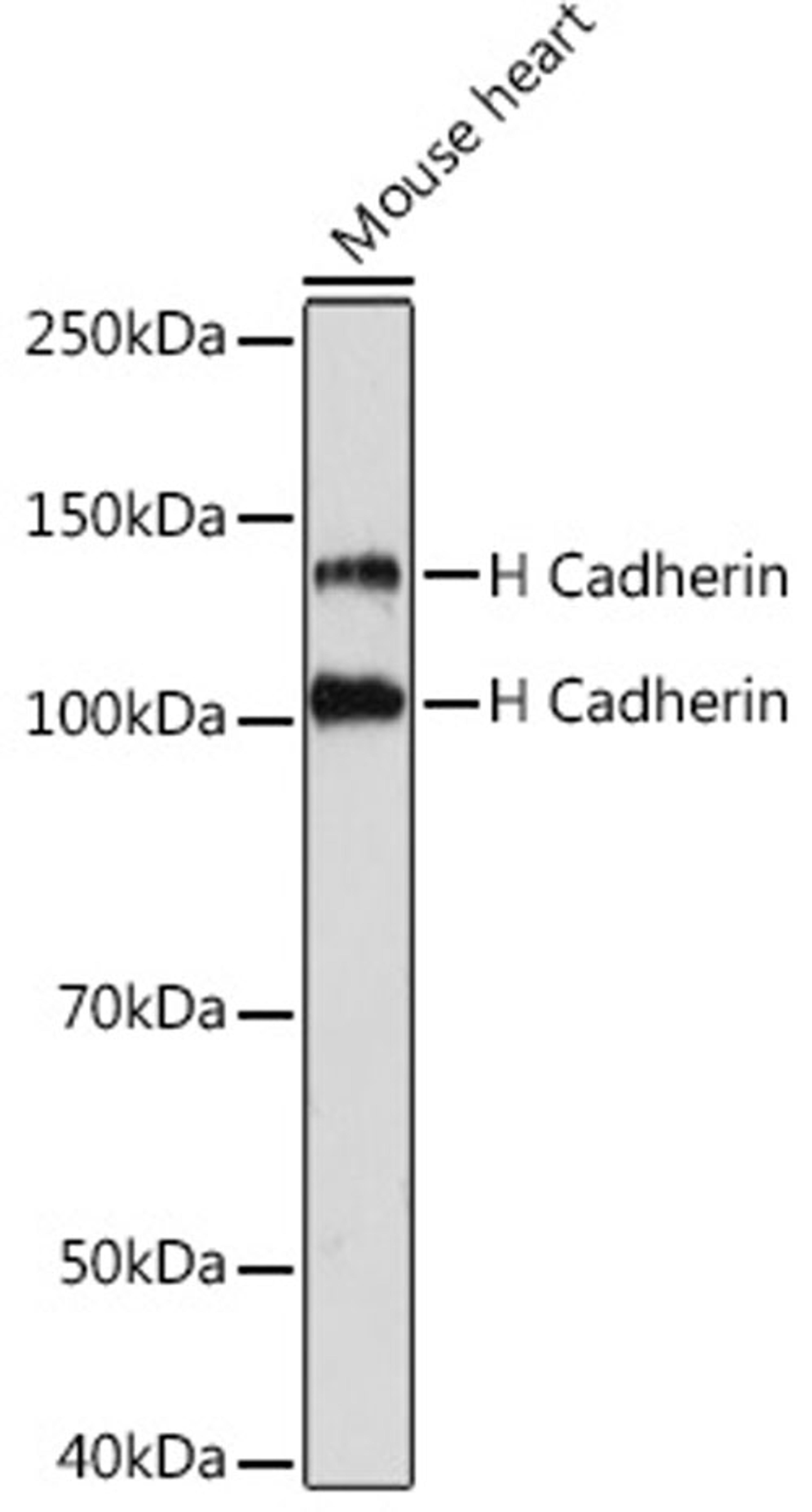 Western blot - H Cadherin Rabbit mAb (A3244)