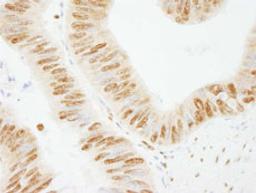 Detection of human PSF/SFPQ by immunohistochemistry.