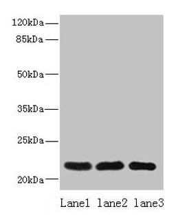 Western blot. All lanes: SSR3 antibody at 10ug/ml. Lane 1: Hela whole cell lysate. Lane 2: U87 whole cell lysate. Lane 3: A431 whole cell lysate. Secondary. Goat polyclonal to rabbit IgG at 1/10000 dilution. Predicted band size: 22, 23 kDa. Observed band size: 22 kDa. 