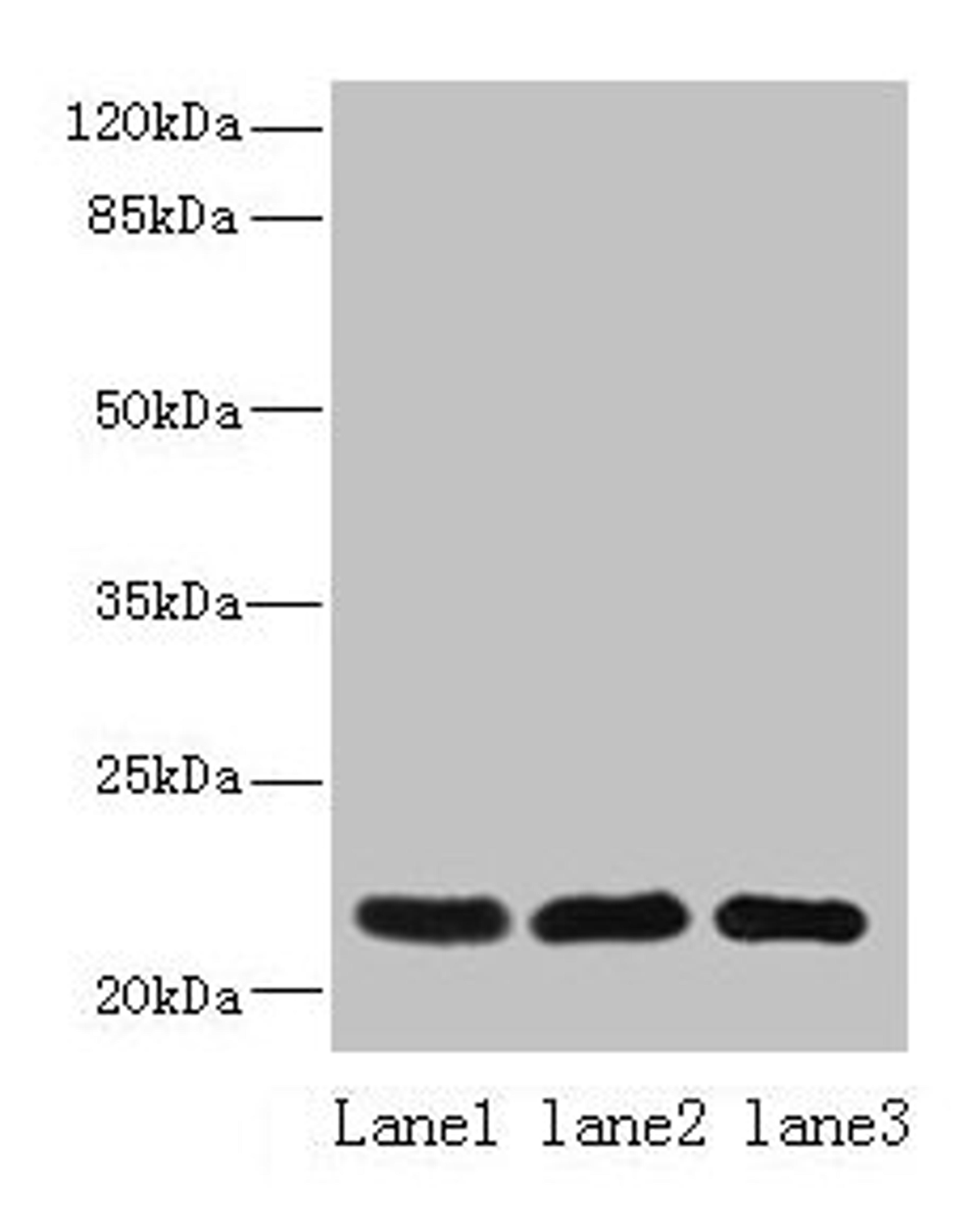 Western blot. All lanes: SSR3 antibody at 10ug/ml. Lane 1: Hela whole cell lysate. Lane 2: U87 whole cell lysate. Lane 3: A431 whole cell lysate. Secondary. Goat polyclonal to rabbit IgG at 1/10000 dilution. Predicted band size: 22, 23 kDa. Observed band size: 22 kDa. 