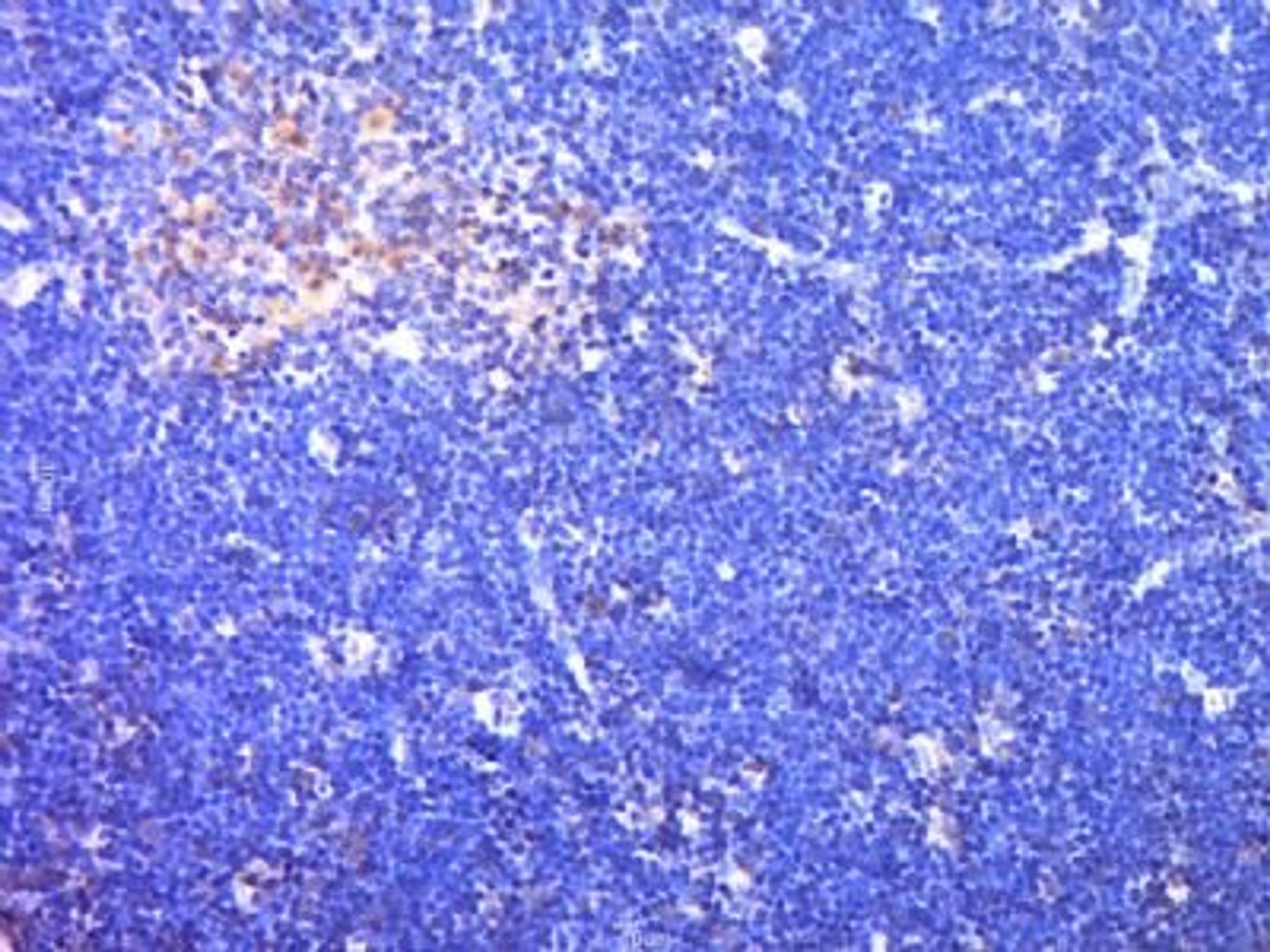 Immunohistochemical staining of Rat thymus tissue using SKAP55 antibody.