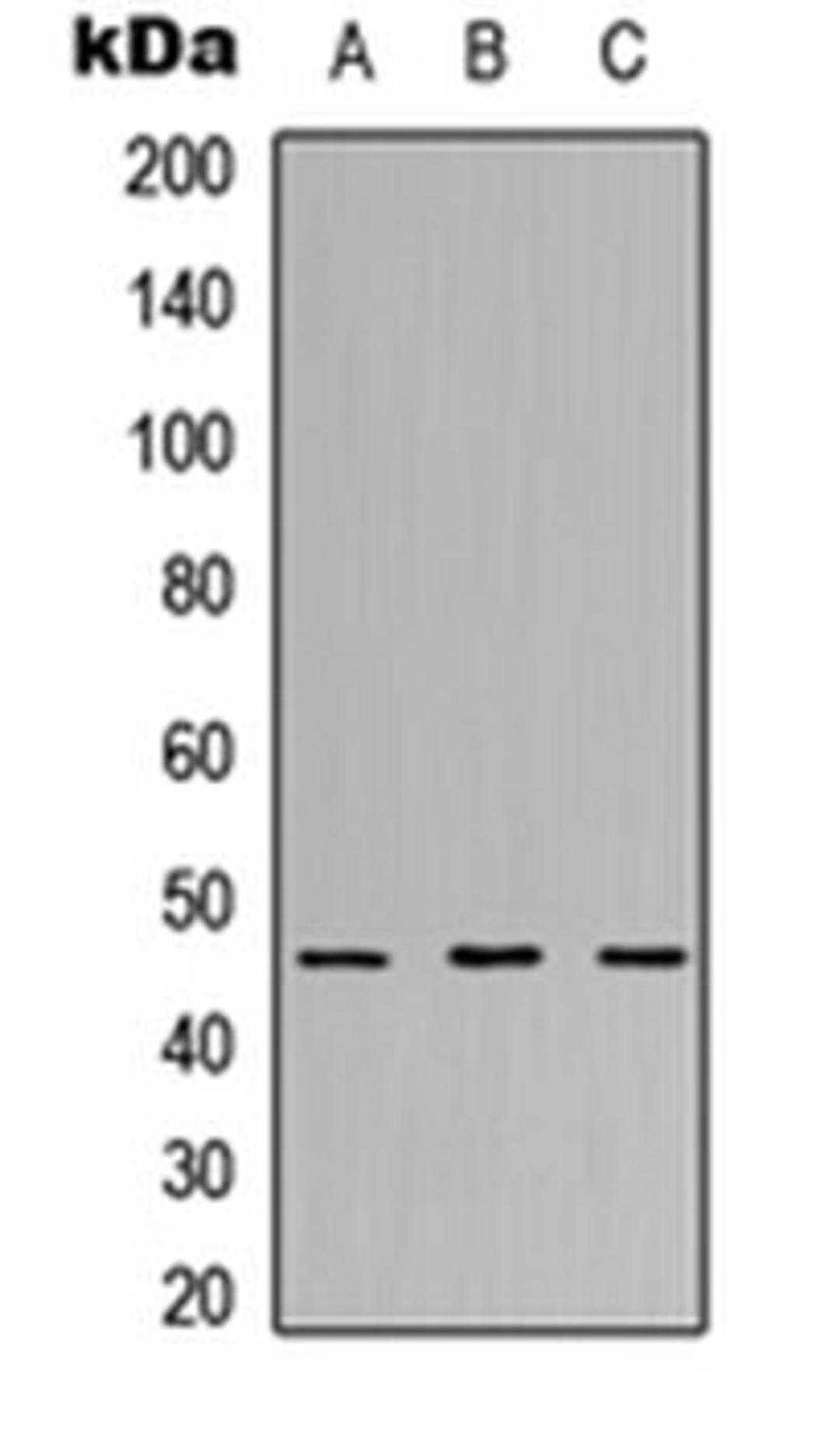 Western blot analysis of MCF7 (Lane 1), NS-1 (Lane 2), PC12 (Lane 3) whole cell lysates using RPL3L antibody