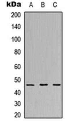 Western blot analysis of MCF7 (Lane 1), NS-1 (Lane 2), PC12 (Lane 3) whole cell lysates using RPL3L antibody