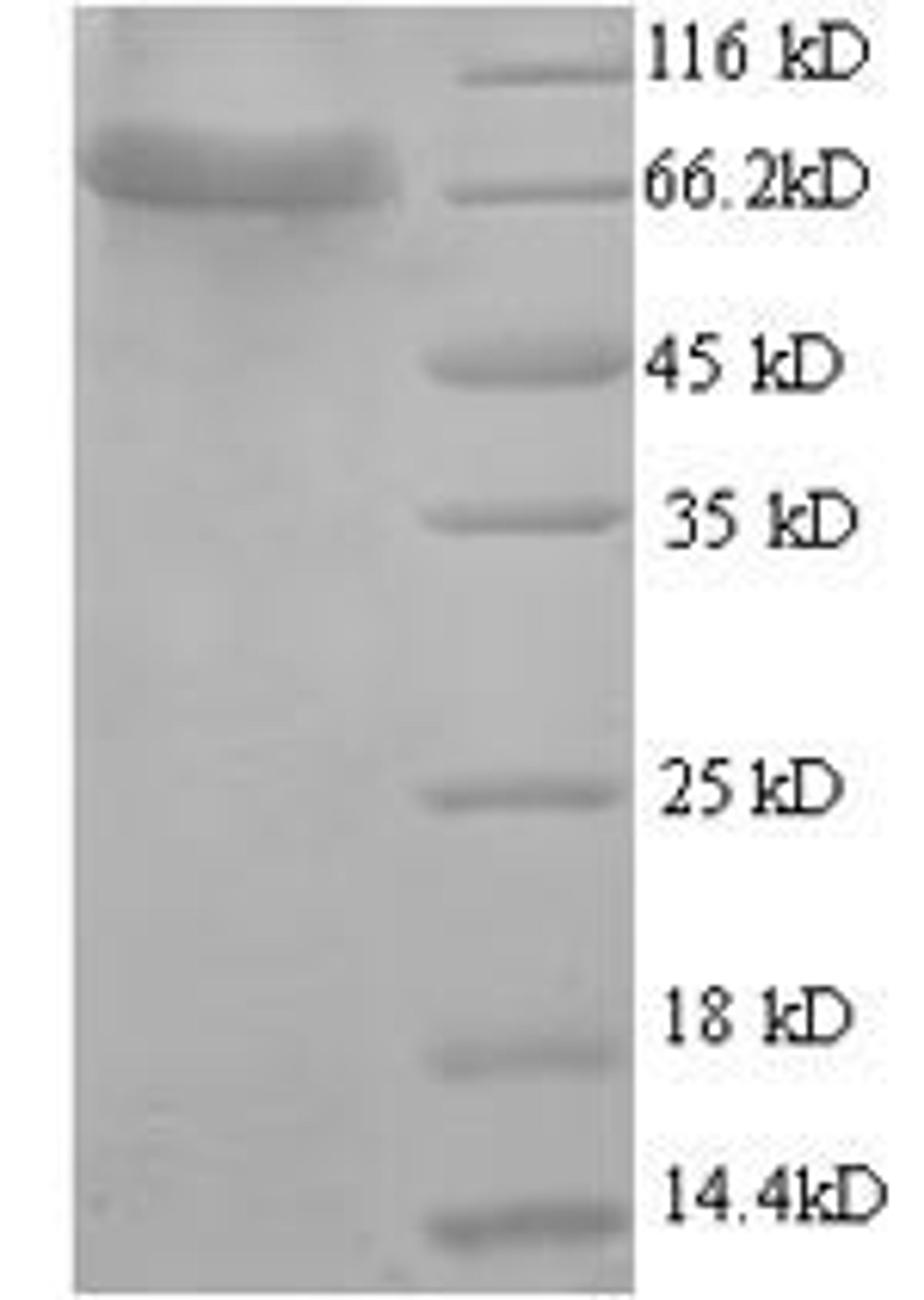 (Tris-Glycine gel) Discontinuous SDS-PAGE (reduced) with 5% enrichment gel and 15% separation gel.